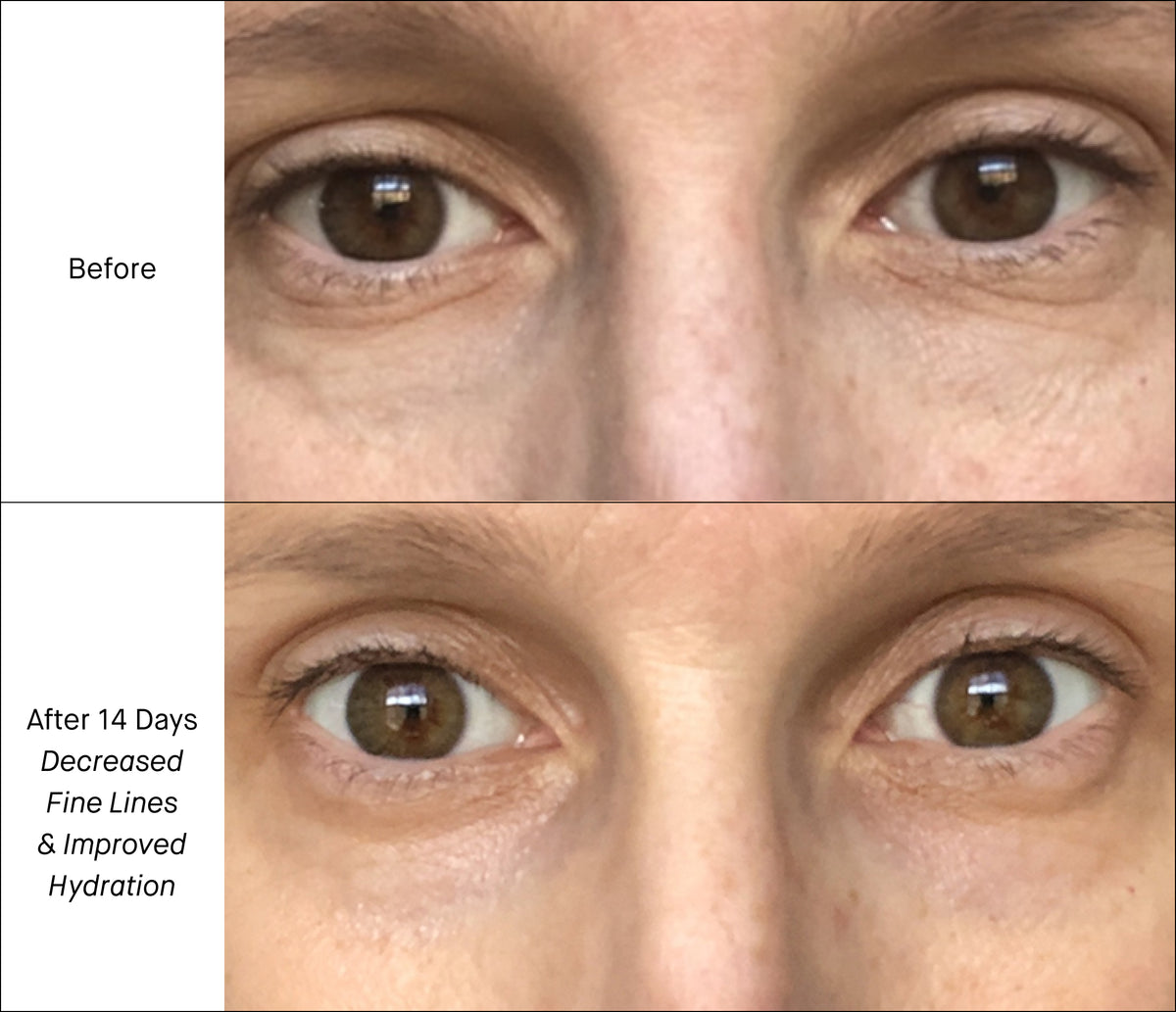 Intensive Eye Renewal Cream Before & After