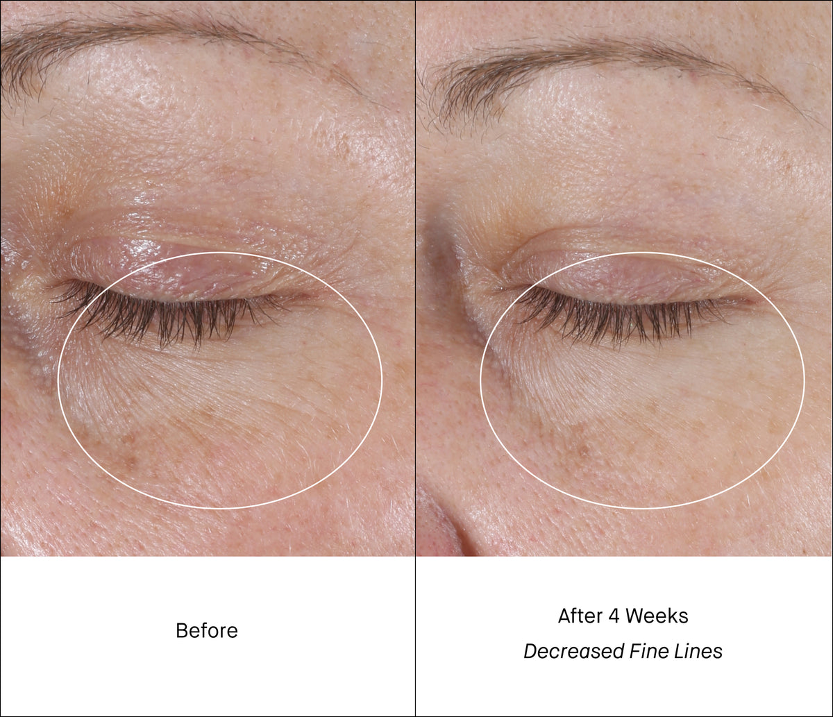 Fine Lines Before & After Intensive Eye Renewal Cream