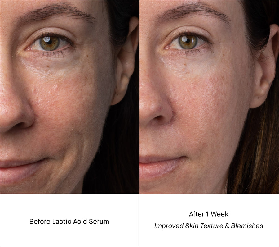 Lactic Acid Serum B&A - Pores & Texture