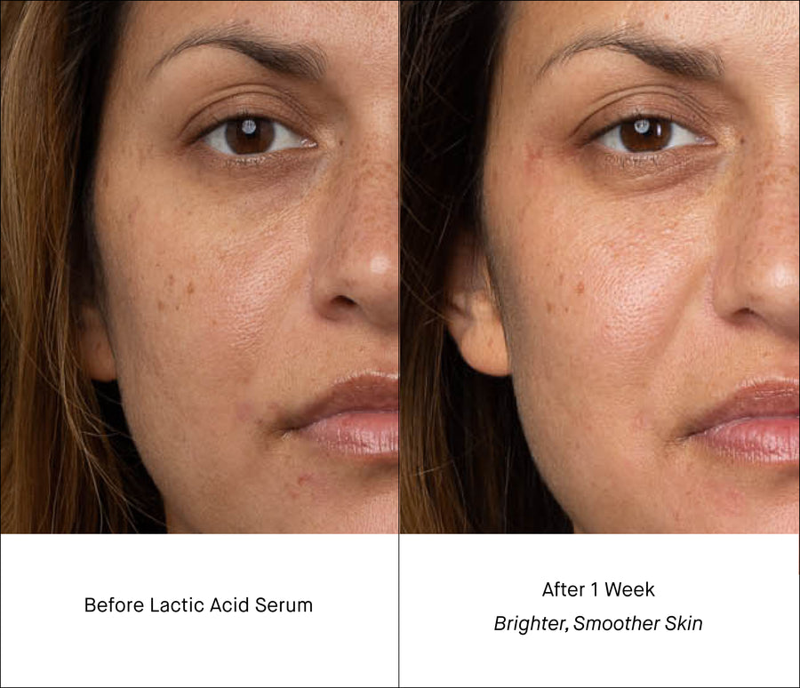 Lactic Acid Serum B&A - Brightness