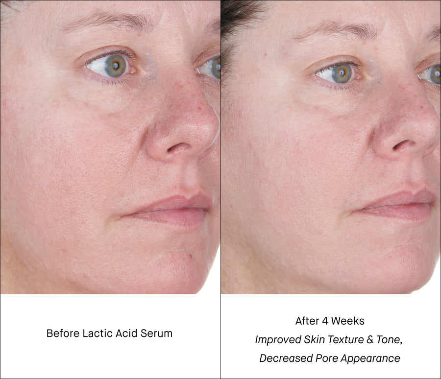Lactic Acid Serum B&A - Pores & Redness