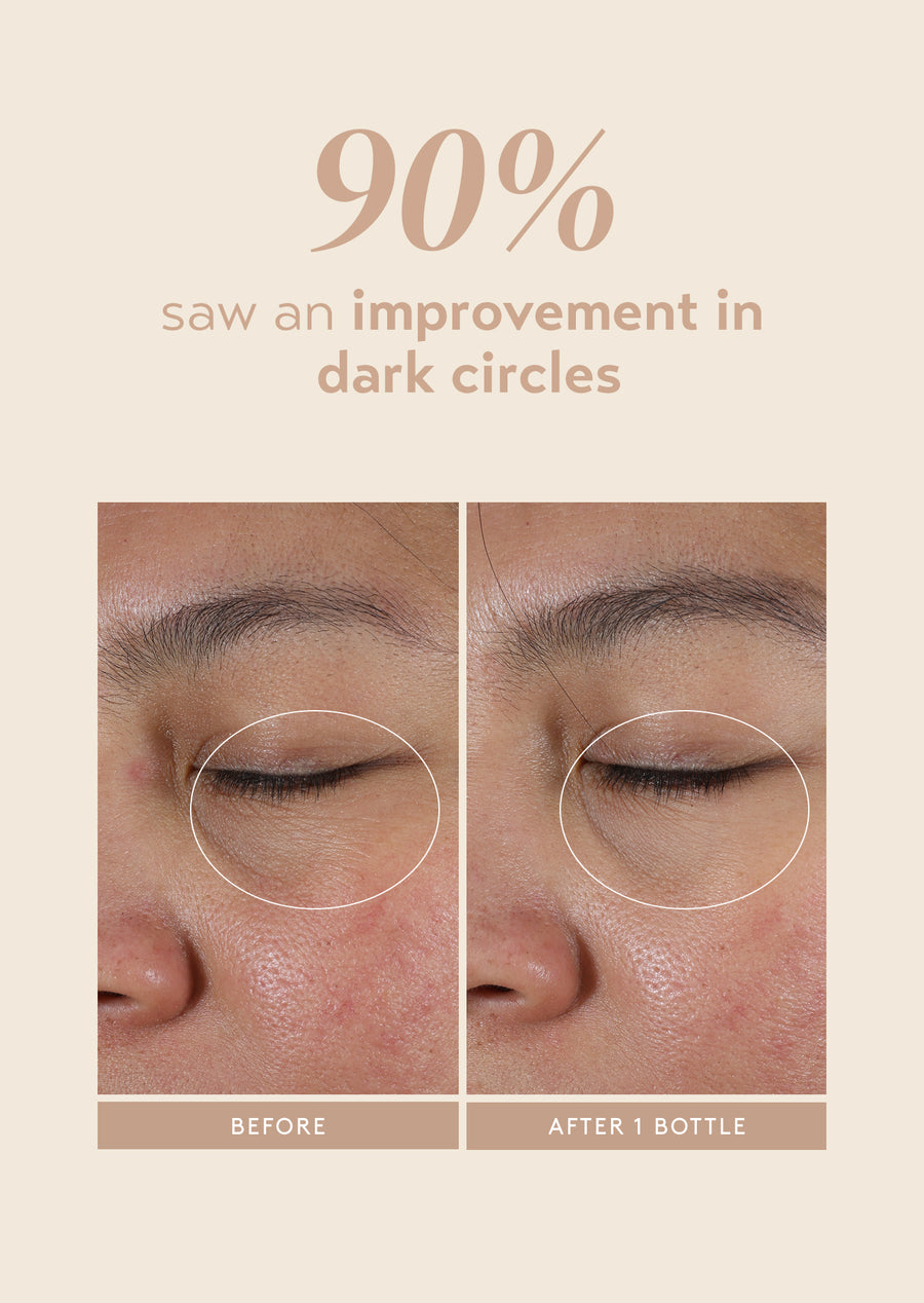 intensive eye renewal cream