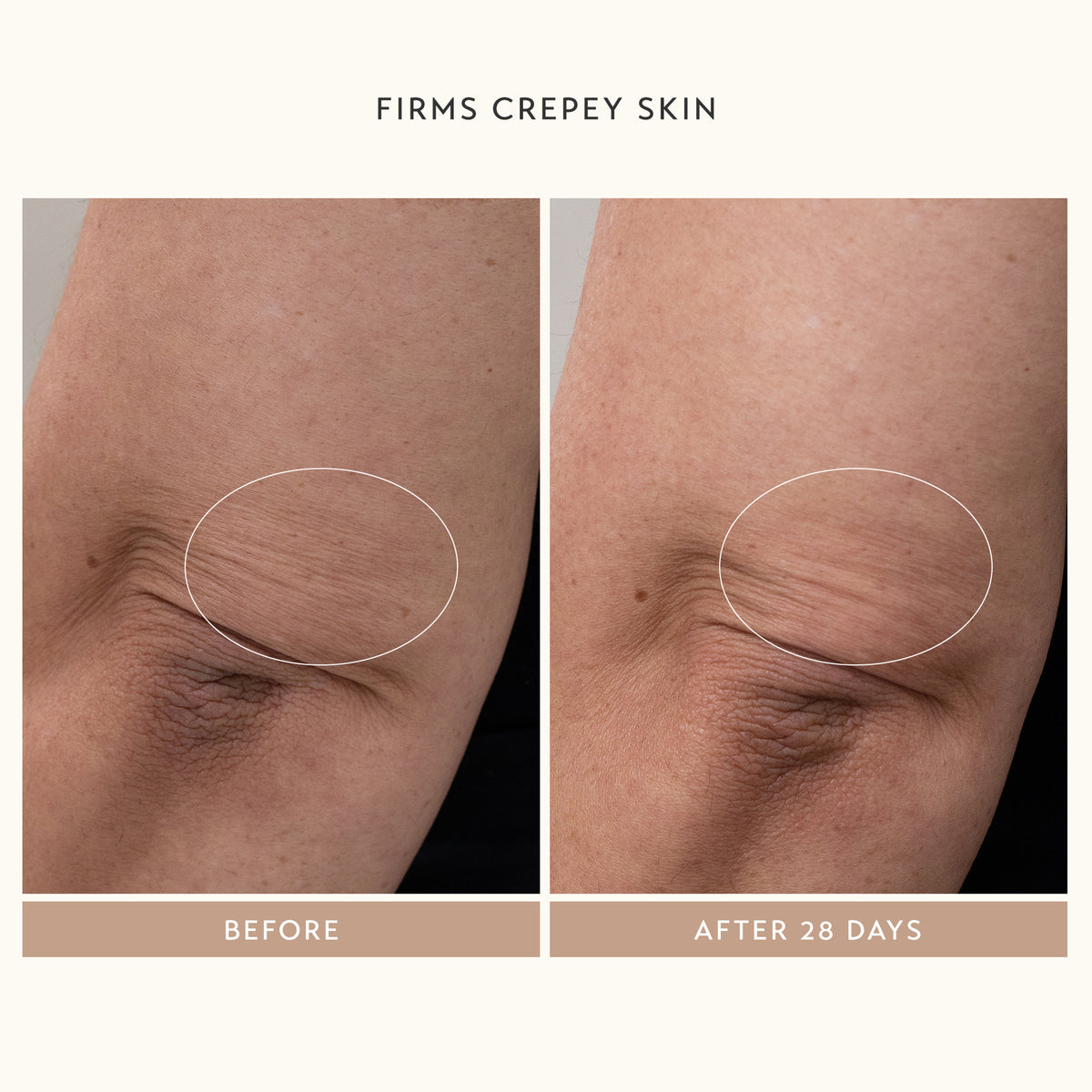 Firms Creepy Skin