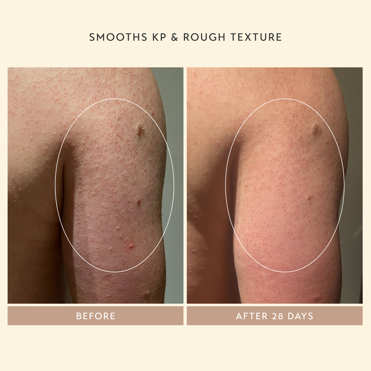 Smooths KP & Rough Texture