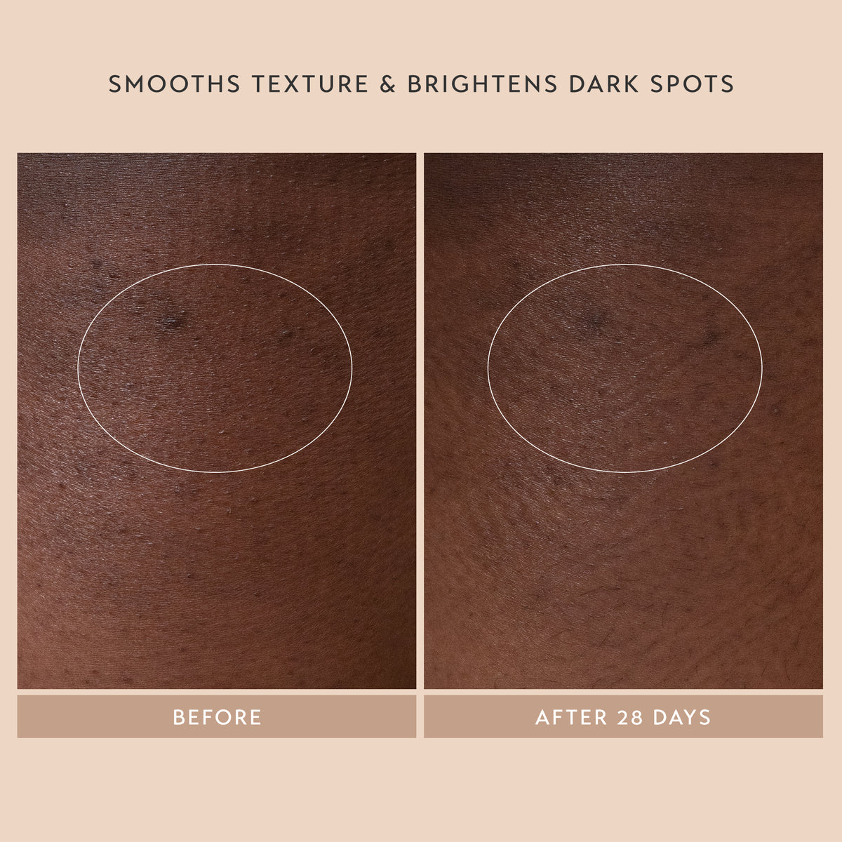 Smooths Texture & Brightens Dark Spots