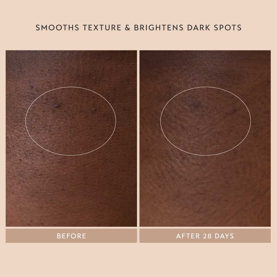 Smooths Texture & Brightens Dark Spots