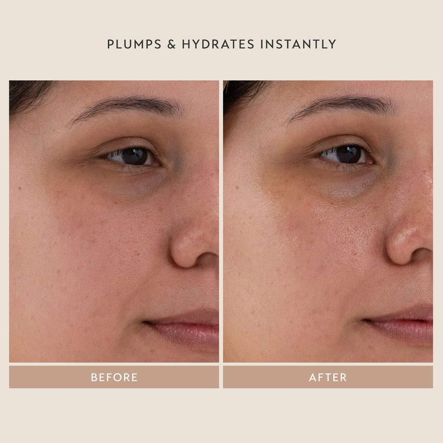 Plumps & Hydrates Instantly