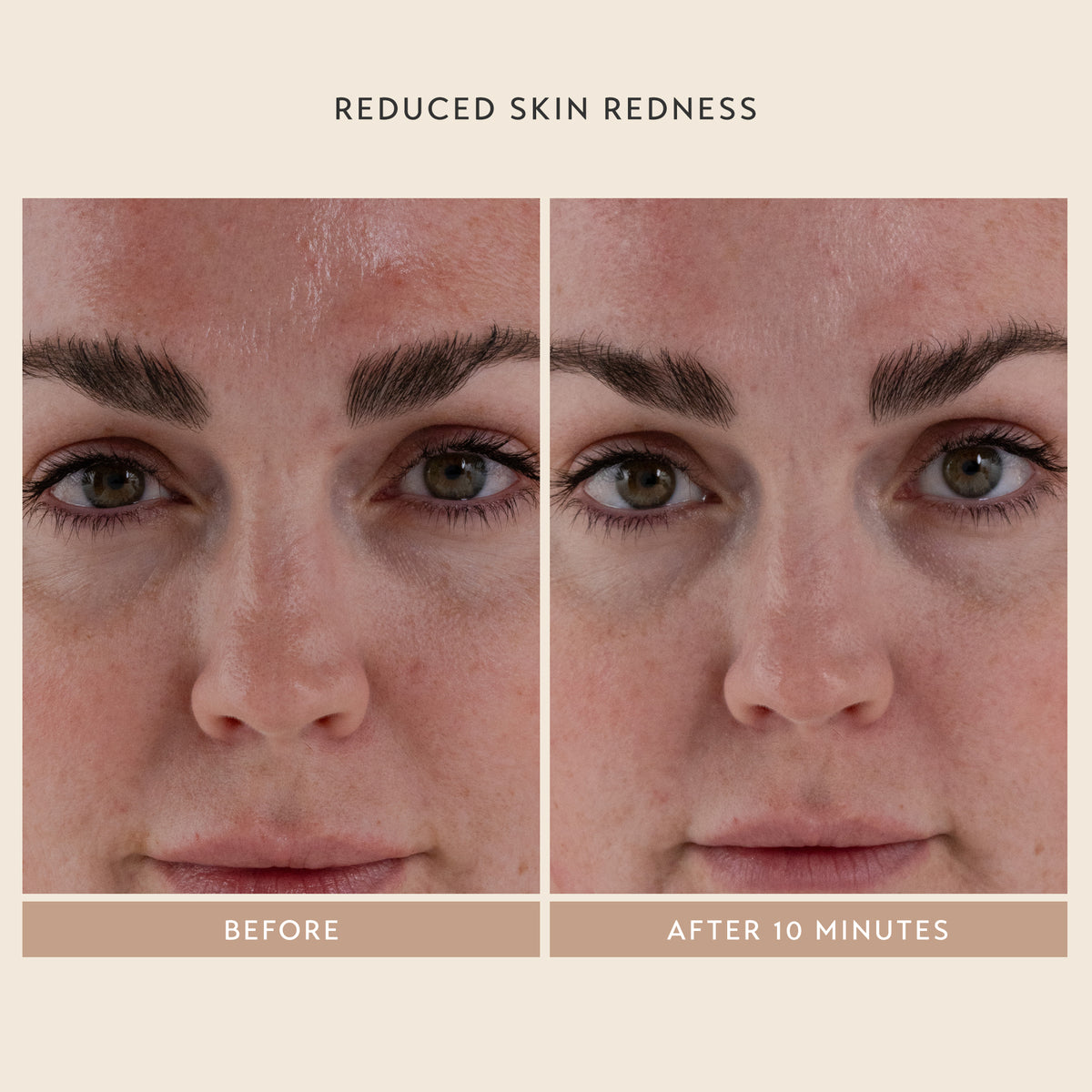 Reduced Skin Redness