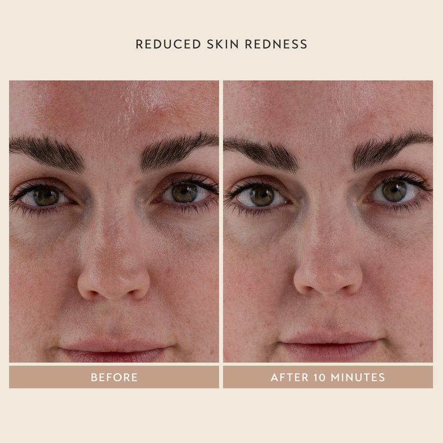 Reduced Skin Redness