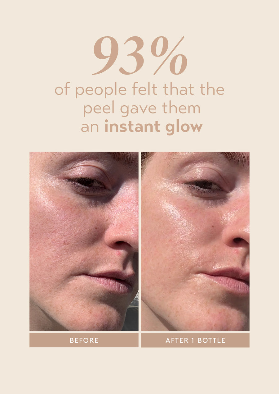 before and after comparison showing improved glow after using shani darden triple acid peel, with 93% of users reporting an instant glow from a clinical study