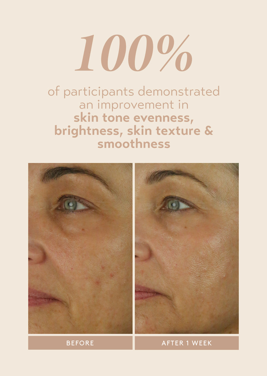 side-by-side before and after photos showing visible skin improvement after 1 week of using shani darden retinol reform 1 % encapsulated retinol serum