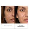 before & after lactic acid serum - brighter, smoother skin