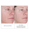 before & after lactic acid serum - improved skin texture tone, decreased pore appearance