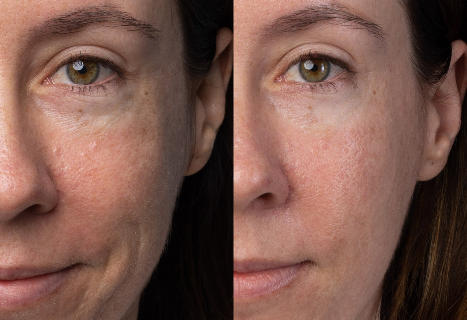 Before & After Lactic Acid Serum