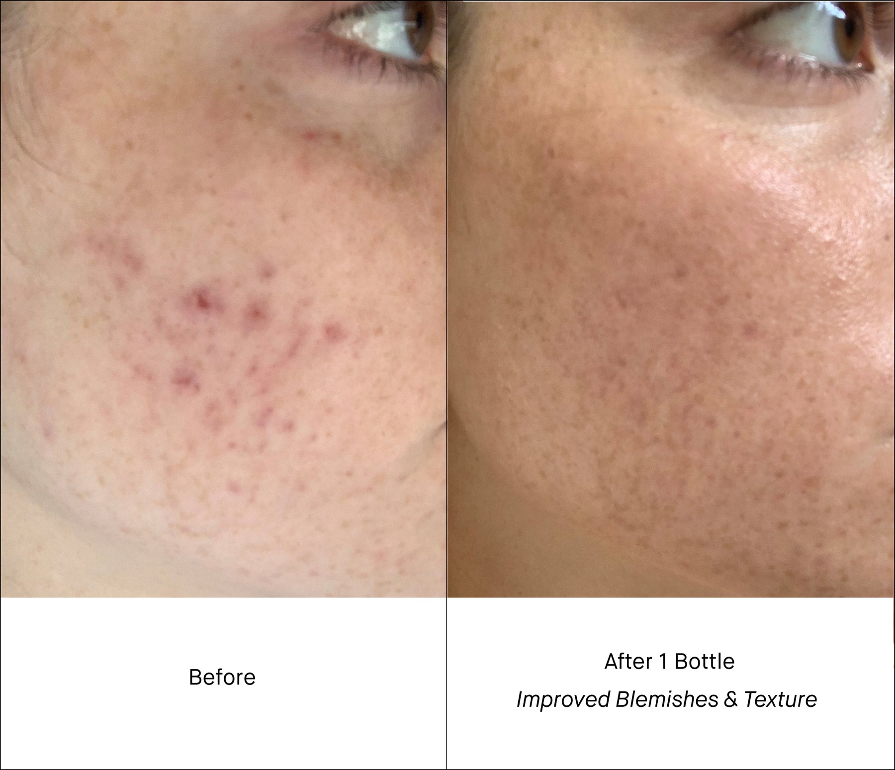 Retinol Reform Duo Shani Darden Skin Care